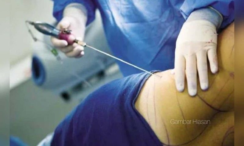Pelakon meninggal dunia, baru dua bulan bersalin terus buat sedut lemak Pelakon meninggal dunia, baru dua bulan bersalin terus buat sedut lemak