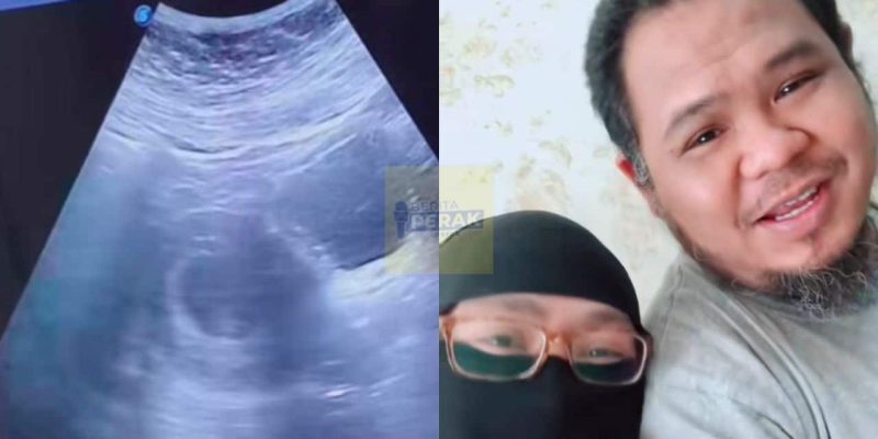 Penantian zuriat 9 tahun berakhir, Taiyuddin Bakar terharu isteri disahkan hamil di usia 40 tahun