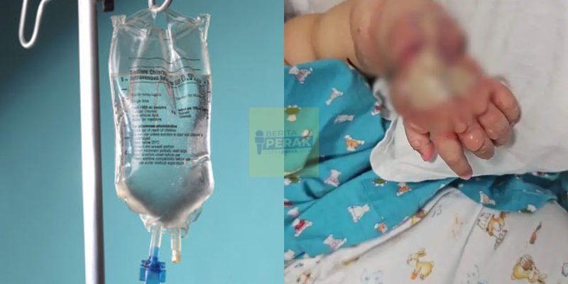 Tangan gelembung teruk, wanita dakwa pihak perubatan bedung bayi terlalu kuat hingga drip tak masuk dengan betul