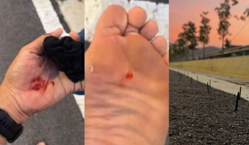 Lelaki cedera terpijak paku yang ditanam dalam tar ketika jogging, netizen syak pelaku pekerja bengkel