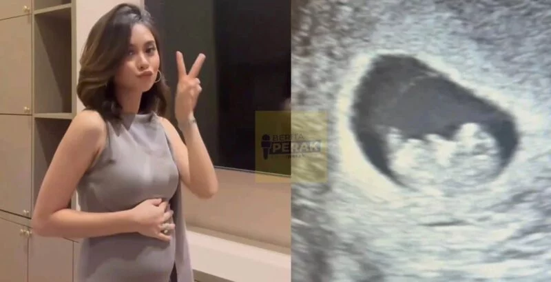 “Rahsia terbongkar” – Hampir setahun berkahwin, Intan Najuwa umum hamil anak pertama “Rahsia terbongkar” – Hampir setahun berkahwin, Intan Najuwa umum hamil anak pertama