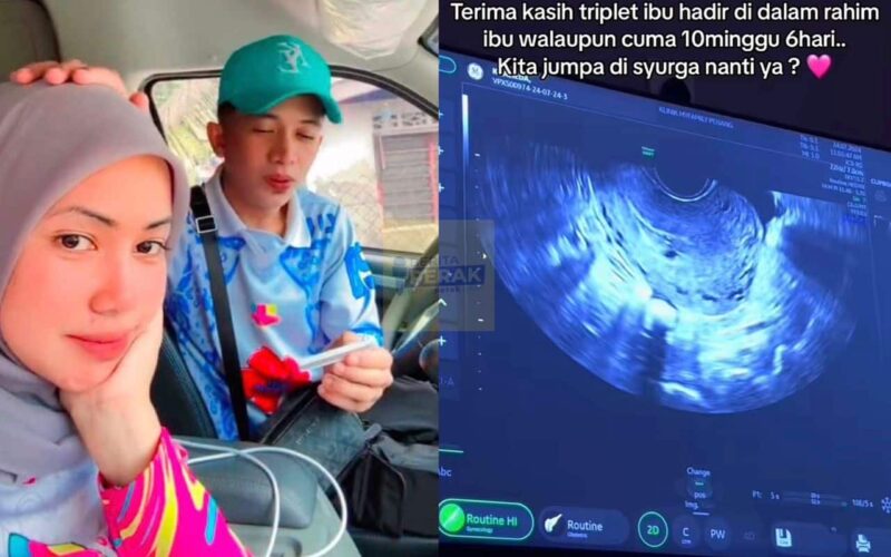 “Patutla alah makin hilang, rupanya..” – Tiada rezeki anak kembar tiga, Kieda Crepe alami keguguran