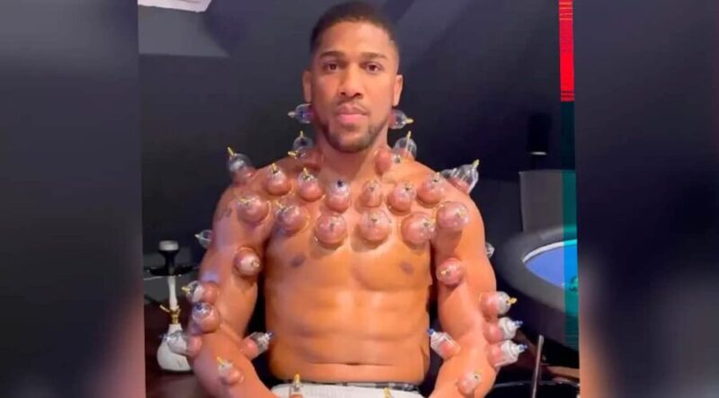 Anthony Joshua dedah rahsia berbekam