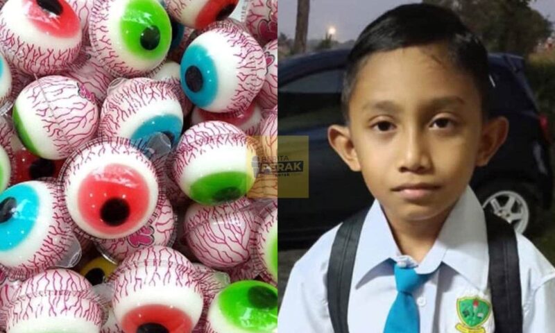 “Dah lama larang tapi apakan daya..” – Budak 10 tahun kritikal tercekik gula-gula ‘gummy’ mata