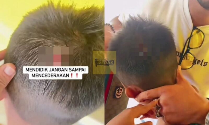 “Melebihlah ni” – Guru didakwa baling kotak pensel sebabkan kepala murid cedera “Melebihlah ni” – Guru didakwa baling kotak pensel sebabkan kepala murid cedera